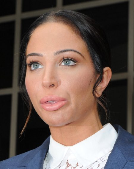 Tulisa Contostavlos Admits To Turning To Cosmetic Surgery After Losing ...